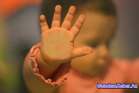 Baş pediatrdan valideynlərə xəbərdarlıq