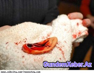 Erməni vəhşiliyi: rəqibin qulağını dişləyib qopardı (FOTO)