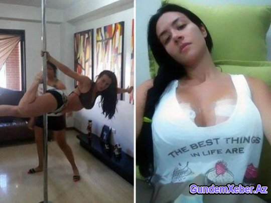 “Playboy” modelinin silikon sinəsi partladı – FOTO