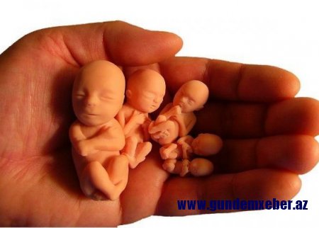 Azərbaycanda 19 məktəbli qız abort etdirib