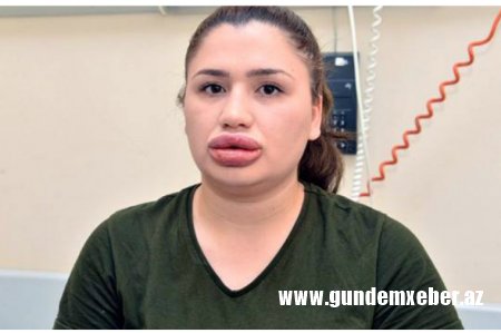 Azərbaycanda təhsil alan saxta həkim Adana həbsxanasından qaçıb — ŞOK HADİSƏ