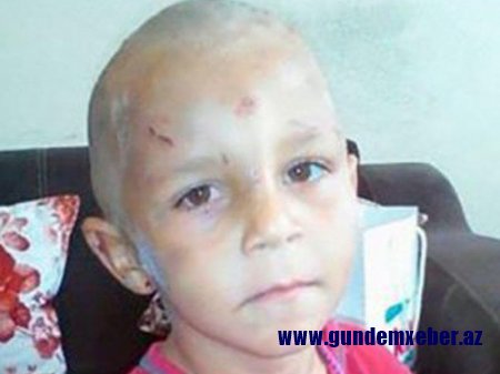 Bakıda 4 yaşlı uşağı döyüb küçəyə atdılar - FOTO