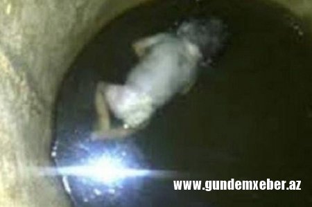 Meyiti quyudan tapılan 6 günlük qızın ölüm — SƏBƏBİ