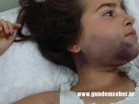 Bakıda 10 yaşlı qızın ağzını bağlayıb 9-cu mərtəbədən atdılar - VİDEO