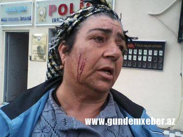 Prezident Administrasiyasında əsgər anasına zorakılıq