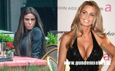 Uğursuz əməliyyat müğənnini tanınmaz hala saldı - Fotolar