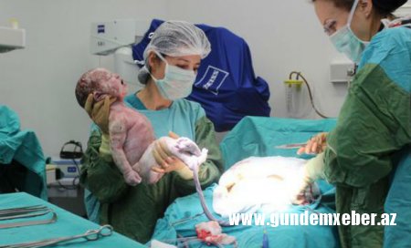 Qəza zamanı Perinatal Mərkəzdə 20 yarımçıq doğulmuş uşaq olub