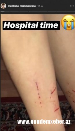 BAKİRƏLİYİNİ SATIŞA ÇIXARAN AZƏRBAYCANLI HÜCUMA MƏRUZ QALDI - FOTOLAR 