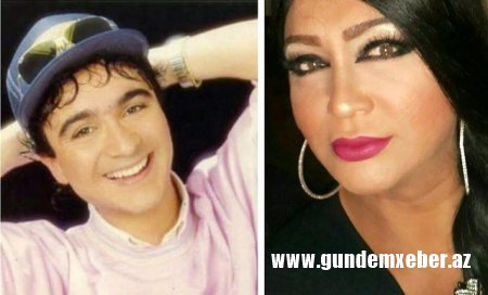 Tanınmış türk müğənni cinsiyyətini dəyişdirdi – FOTO