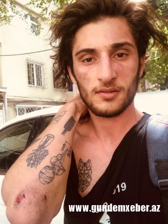 SON DƏQİQƏ: Mobil jurnalist Nurlan Libre döyüldü-FOTOLAR 