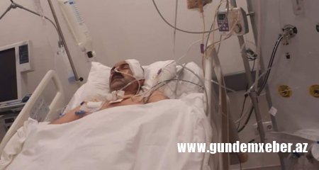 Oqtay Gülalıyevin vəziyyəti yaxşılaşır
