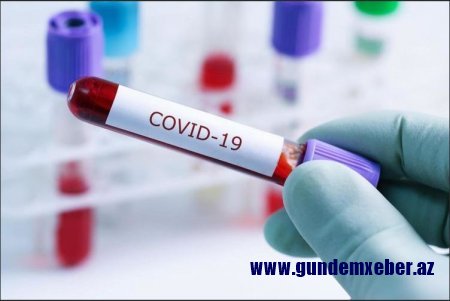 Azərbaycanda daha 15 nəfərdə koronavirus aşkarlandı