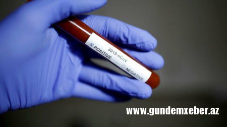 ABŞ ordusu dünyaya elan etdi: siçanlarda koronavirus peyvəndi sınandı