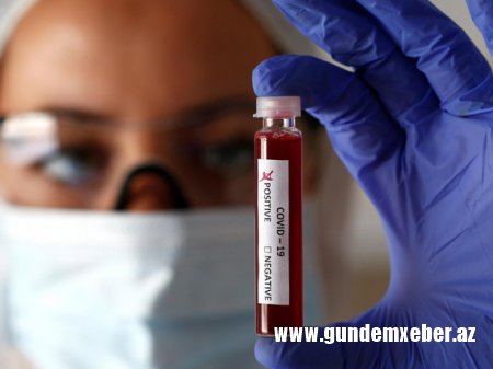Ermənistan koronavirusun yayılmasının nəzarətdən çıxdığını açıqladı