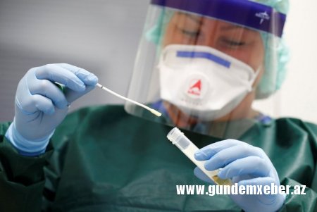 Azərbaycanda daha 33 nəfər koronavirusa yoluxub, 62 nəfər sağalıb