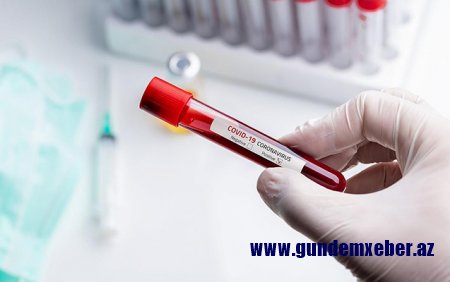 Daha 52 nəfərdə koronavirus tapıldı - 1 nəfər vəfat etdi, 39 nəfər sağaldı