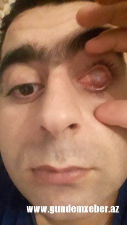 Sahil Babayev xalqı barmağına doladığı kimi, ölkə rəhbərliyini də saymır – Şikayət