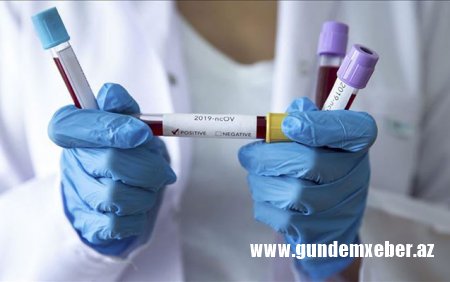 Azərbaycanda daha 70 nəfərdə koronavirus aşkarlandı - 30 pasiyent sağaldı