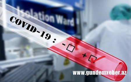 Daha 339 nəfərdə koronavirus aşkarlandı - 4 nəfər vəfat etdi