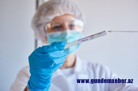 Azərbaycanda daha 412 nəfər koronavirusa yoluxub, 7 nəfər vəfat edib - 631 nəfər sağalıb