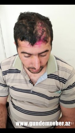 Şəkidə təhqiqatçının qərarı qarşıdurmanı “pik nöqtə”yə çatdırıb – FOTO/FAKT