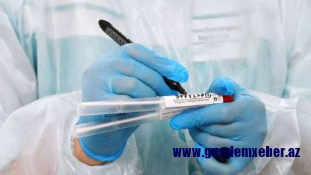 Özəl klinikalarda koronavirus testlərinin qiymətləri endirilə bilər? - AÇIQLAMA