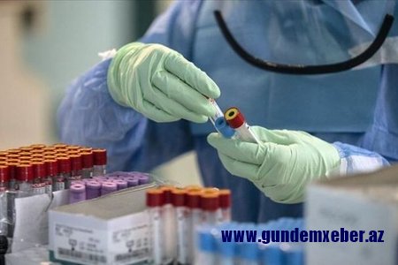 TƏBİB rəsmisi: "Azərbaycanda koronavirusa yoluxmada pik vəziyyətdən sonra azalma var”