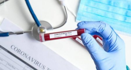 Azərbaycanda son sutkada 11 nəfər koronavirusa yoluxub, ölən olmayıb