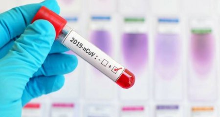 Azərbaycanda son sutkada 12 nəfər koronavirusa yoluxub