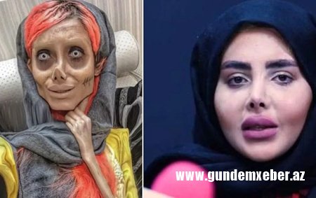 Ancelina Coliyə bənzəmək üçün 50 dəfə əməliyyat olunan iranlı qadın həbsdən buraxıldı – VİDEO