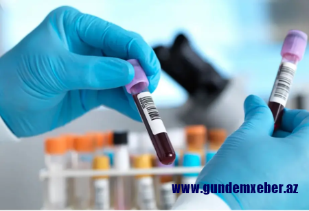 Hepatit C ilə mübarizədə tarixi nəticə: İngiltərə hədəfə vaxtından əvvəl çatıb
